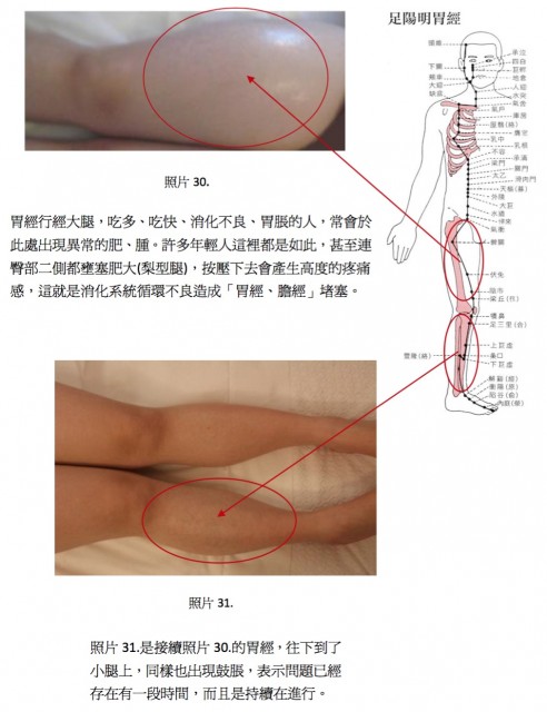 照片卅、卅一、足陽明胃經.jpg